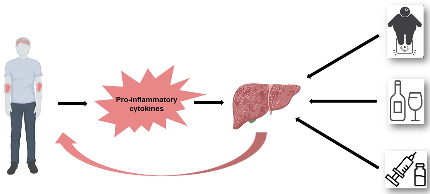 A diagram of a liver<br srcset=